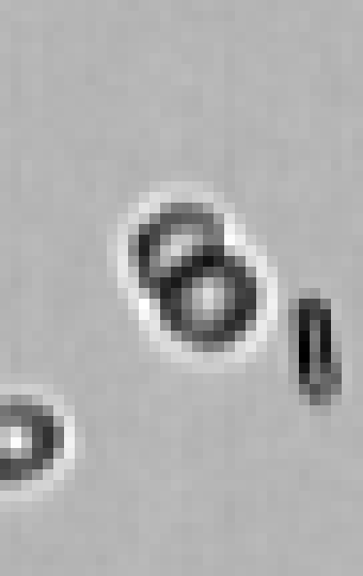 Raw brightfield frame with several cells, some touching