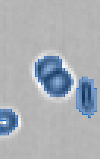 The same frame segmented by traditional thresholding: one mask covers every cell, and touching cells merge